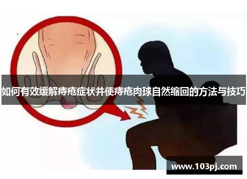 如何有效缓解痔疮症状并使痔疮肉球自然缩回的方法与技巧 如何有效缓解痔疮症状并使痔疮肉球自然缩回的方法与技巧