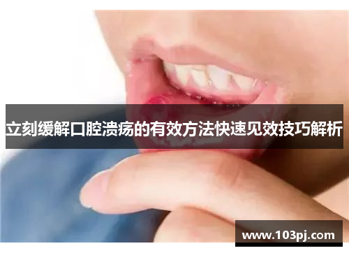 立刻缓解口腔溃疡的有效方法快速见效技巧解析 立刻缓解口腔溃疡的有效方法快速见效技巧解析